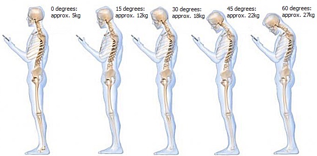 Vision posture Text-Neck Vision posture Text-Neck